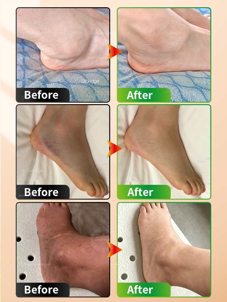 Masajeador de Tobillo Portátil - Ankle Mobility Band reseña y precio